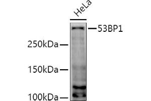 Western blot analysis of extracts of HeLa cells, using 53BP1 antibody (ABIN6128833, ABIN6149414, ABIN6149415 and ABIN6221431) at 1:1000 dilution.
