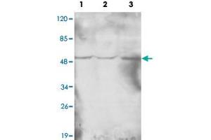 Western blot analysis of HAT1 monoclonal antibody  at 1 : 1000 dilution. (HAT1 anticorps  (N-Term))