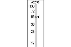 Western blot analysis of PDIA3 Antibody in A2058 cell line lysates (35ug/lane) (PDIA3 anticorps  (C-Term))