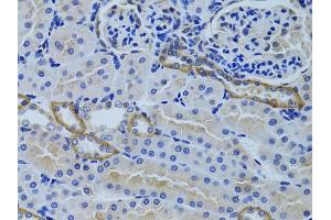 Immunohistochemistry of paraffin-embedded rat kidney using FHL2 antibody (ABIN5975345) at dilution of 1/100 (40x lens). (FHL2 anticorps)
