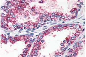 anti-5-Hydroxytryptamine (serotonin) Receptor 2A (HTR2A) (N-Term) antibody