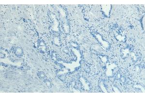 ABIN184638 Negative Control showing staining of paraffin embedded Human Prostate, with no primary antibody.