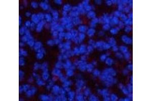 Immunofluorescence analysis of Mouse spleen tissue using PDGFRA Monoclonal Antibody at dilution of 1:200.