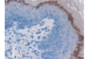 DAB staining on IHC-P; Samples: Mouse Esophagus Tissue (WFDC5 anticorps  (AA 1-126))