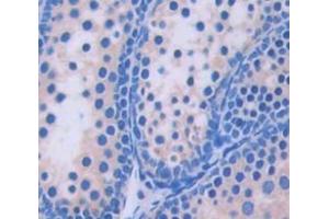 Used in DAB staining on fromalin fixed paraffin- embedded Kidney tissue (PEX1 anticorps  (AA 172-377))