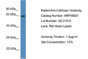 Western Blotting (WB) image for anti-CDK5 Regulatory Subunit Associated Protein 1 (CDK5RAP1) (C-Term) antibody (ABIN2774168) (CDK5RAP1 anticorps  (C-Term))