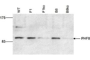 Western Blot results of Rabbit anti-PHF8 antibody Western Blot results of Rabbit anti-PHF8 antibody. (PHF8 anticorps)