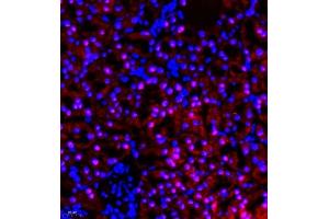 Immunofluorescence of paraffin embedded rat kidney using RBAK (ABIN7075383) at dilution of 1:400 (400x lens) (RBAK anticorps)
