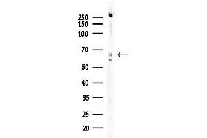 anti-NAD Dependent Malate Dehydrogenase (NAD-ME) (Internal Region) antibody