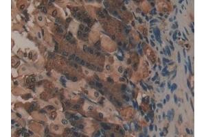 Detection of COL1a1 in Mouse Stomach Tissue using Polyclonal Antibody to Collagen Type I Alpha 1 (COL1a1)