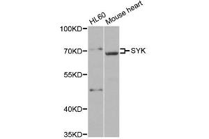 Western blot analysis of extracts of various cell lines, using SYK antibody.