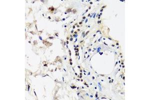 Immunohistochemistry of paraffin-embedded human lung using C antibody (ABIN7266546) at dilution of 1:100 (40x lens). (CAND1 anticorps  (AA 750-980))
