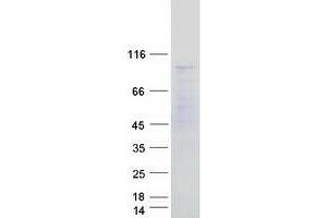 Validation with Western Blot