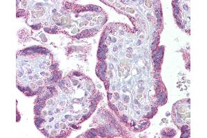 Anti-TRPC4 antibody IHC of human placenta.