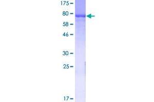 Image no. 1 for Glutamate Decarboxylase 2 (Pancreatic Islets and Brain, 65kDa) (GAD2) (AA 1-585) protein (GST tag) (ABIN1354671)