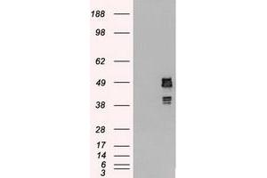 Image no. 12 for anti-Sjogren Syndrome Antigen B (SSB) antibody (ABIN1501146)