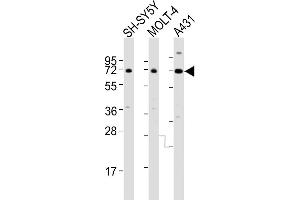 All lanes : Anti-HTR2C Antibody (Center) at 1:4000 dilution Lane 1: SH-SY5Y whole cell lysates Lane 2: MOLT-4 whole cell lysates Lane 3: A431 whole cell lysates Lysates/proteins at 20 μg per lane. (HTR2C anticorps  (AA 274-308))