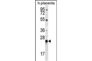 Western blot analysis in human placenta tissue lysates (35ug/lane). (LHFPL1 anticorps  (N-Term))