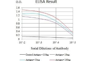 Black line: Control Antigen (100 ng),Purple line: Antigen (10 ng), Blue line: Antigen (50 ng), Red line:Antigen (100 ng)