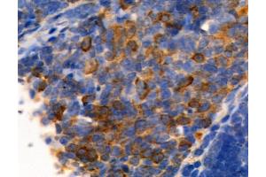 ABIN6261455 and ABIN6277691 at 1/100 staining Mouse thymus tissue by IHC-P. (Ephrin B2 anticorps  (C-Term))