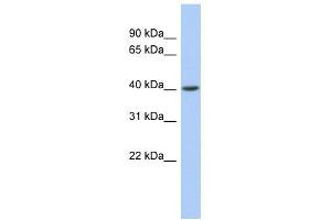 ACADS antibody used at 1 ug/ml to detect target protein.