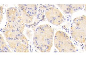 Detection of a2M in Human Stomach Tissue using Polyclonal Antibody to Alpha-2-Macroglobulin (a2M)