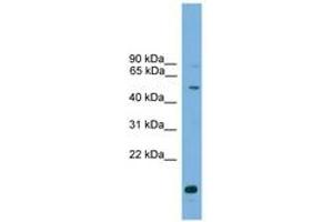 Image no. 1 for anti-Autophagy related 4C Cysteine Peptidase (ATG4C) (AA 175-224) antibody (ABIN6745509)