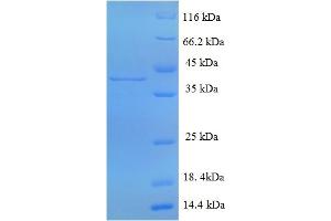 SDS-PAGE (SDS) image for Cathepsin G (CTSG) (AA 21-261) protein (His-SUMO Tag) (ABIN5709357)