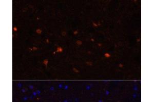 Immunofluorescence analysis of Mouse brain using S100B Polyclonal Antibody at dilution of 1:100. (S100B anticorps)