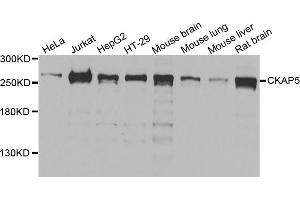 Western blot analysis of extracts of various cell lines, using CKAP5 antibody. (CKAP5 anticorps)