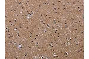 The image on the left is immunohistochemistry of paraffin-embedded Human brain tissue using ABIN7128956(CLDND1 Antibody) at dilution 1/50, on the right is treated with fusion protein. (CLDND1 anticorps)