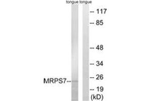 Western blot analysis of extracts from rat tongue cells, using MRPS7 Antibody. (MRPS7 anticorps  (AA 91-140))