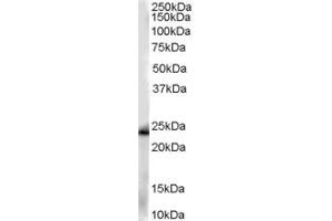 ABIN185418 (0. (GSTP1 anticorps  (Internal Region))