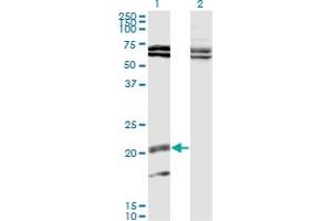 Western Blot analysis of IL17B expression in transfected 293T cell line by IL17B monoclonal antibody (M02), clone 1G6. (IL17B anticorps  (AA 23-122))