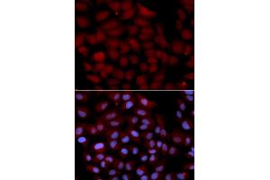 Immunofluorescence analysis of U2OS cells using TNK2 antibody (ABIN5971357). (TNK2 anticorps)
