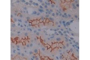 Figure. (MUC13 anticorps  (AA 174-404))