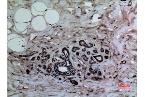 Immunohistochemistry (IHC) analysis of paraffin-embedded Human Breast, antibody was diluted at 1:100.