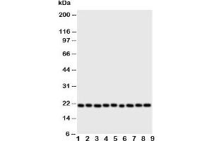 Western blot testing of Cytoglobin antibody and Lane 1:  rat brain;  2: (r) small intestine;  3: (r) liver;  4: (r) kidney;  5: human SGC;  6: (h) COLO320;  7: SMMC-7721;  8: PANC;  9: HeLa cell lysate. (CYGB anticorps  (N-Term))