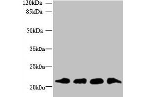 Western blot All lanes: MRPL18 antibody at 8 μg/mL Lane 1: U251 whole cell lysate Lane 2: THP-1 whole cell lysate Lane 3: PC-3 whole cell lysate Lane 4: U87 whole cell lysate Secondary Goat polyclonal to rabbit IgG at 1/10000 dilution Predicted band size: 21 kDa Observed band size: 21 kDa (MRPL18 anticorps  (AA 14-180))