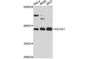 Western blot analysis of extracts of various cell lines, using DEGS1 antibody (ABIN6294024) at 1:3000 dilution. (DEGS1 anticorps)