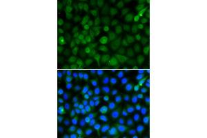 Immunofluorescence analysis of A549 cells using HIST2H4B antibody (ABIN5974305). (Histone Cluster 2, H4b (HIST2H4B) anticorps)