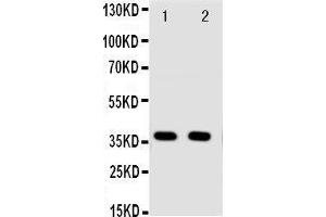 Anti-Annexin A10 antibody, Western blotting Lane 1: A549 Cell Lysate Lane 2: A549 Cell Lysate (Annexin a10 anticorps  (C-Term))