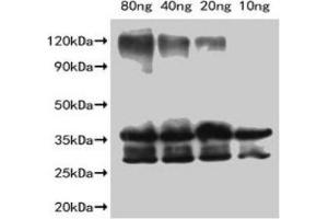 anti-Schlafen 9 (SLFN9) (AA 1-83) antibody