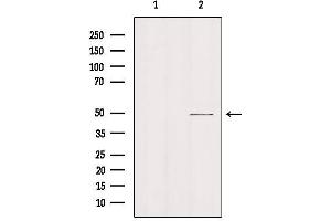 Western blot analysis of extracts from hybridoma cells, using MOT11 Antibody. (SLC16A11 anticorps  (N-Term))