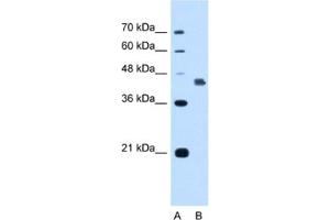 Western Blotting (WB) image for anti-Deafness, Autosomal Dominant 5 (DFNA5) antibody (ABIN2462940) (DFNA5 anticorps)