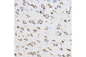 Immunohistochemistry of paraffin-embedded rat brain using RPL23 Rabbit pAb (ABIN1682575, ABIN5664722, ABIN5664724 and ABIN6220574) at dilution of 1:100 (40x lens).