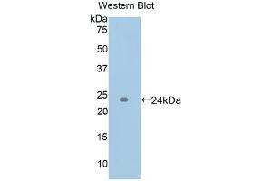 Western blot analysis of the recombinant protein. (ICAM4 anticorps  (AA 52-234))