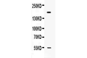Western blot analysis of Collagen I expression in MCF-7 whole cell lysates ( Lane 1). (COL1A1 anticorps  (C-Term))