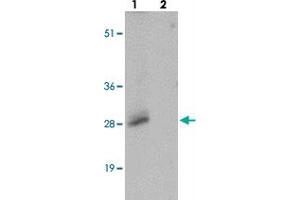 Western blot analysis of SHISA3 in human small intestine tissue with SHISA3 polyclonal antibody  at 1 ug/mL in (lane 1) the absence and (lane 2) the presence of blocking peptide.