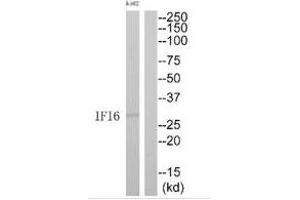 Western blot analysis of extracts from K562 cells, using IFI6 antibody. (IFI6 anticorps  (C-Term))
